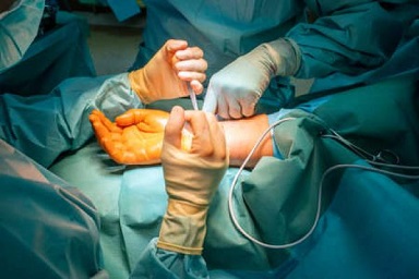 Hand &amp; Reconstructive Microsurgery